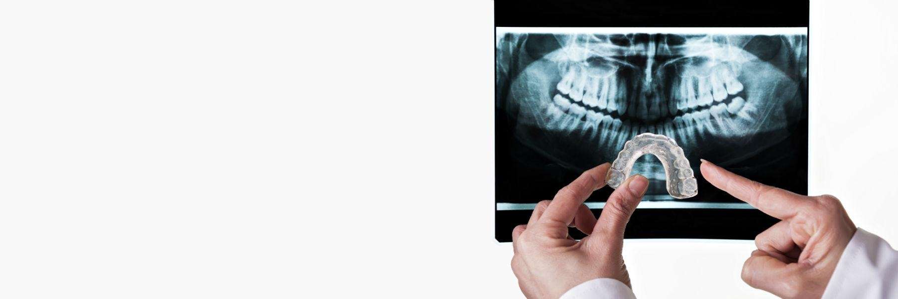 TMJ and Bruxism Treatment | Dentist